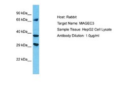 MAGEC3 Rabbit anti-Human, Polyclonal, Novus Biologicals 0.1ml; Unconjugated:Antibodies,